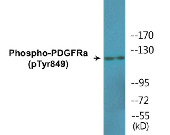 PDGFRa Phospho-Tyr849 Colorimetric Cell-Based ELISA Kit