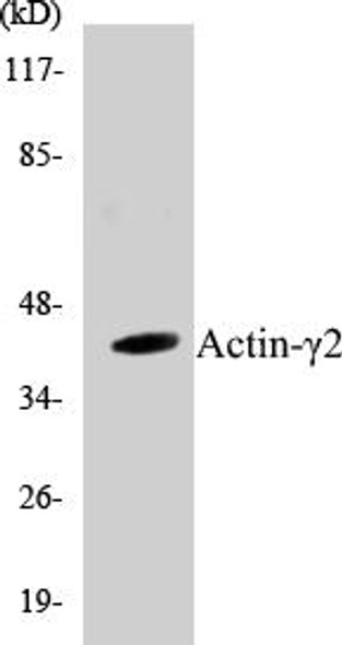 Actin-gamma2 Colorimetric Cell-Based ELISA Kit