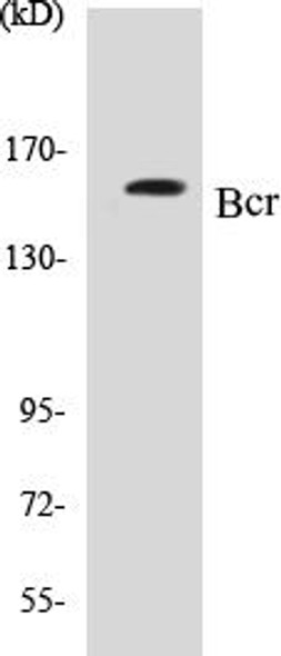 Bcr Colorimetric Cell-Based ELISA Kit