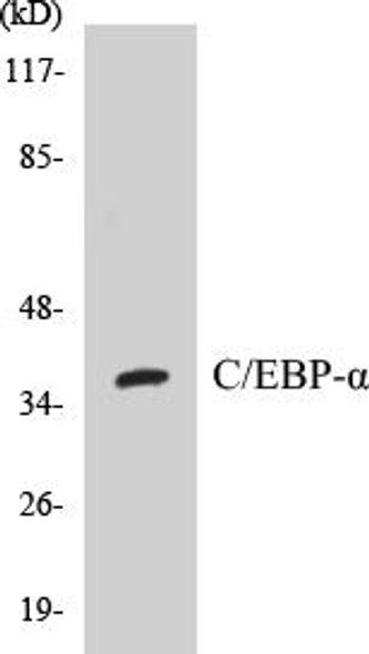 Immunology C/EBP-alpha Colorimetric Cell-Based ELISA Kit