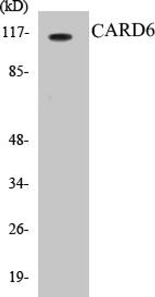 Cell Death CARD6 Colorimetric Cell-Based ELISA Kit