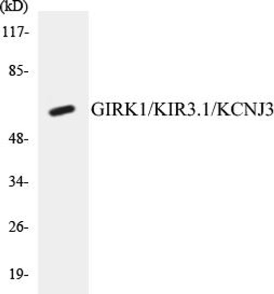 Signal Transduction GIRK1/KIR3.1/KCNJ3 Colorimetric Cell-Based ELISA Kit