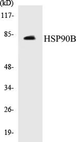 Metabolism HSP90B Colorimetric Cell-Based ELISA Kit