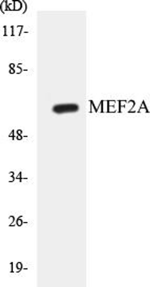 Cell Death MEF2A Colorimetric Cell-Based ELISA Kit