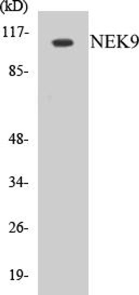 Cell Cycle ELISA Kits NEK9 Colorimetric Cell-Based ELISA Kit