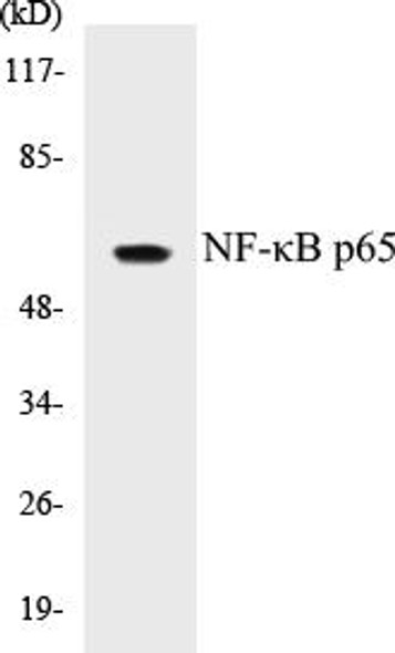 Immunology NF-kappaB p65 Colorimetric Cell-Based ELISA Kit