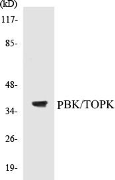 PBK/TOPK Colorimetric Cell-Based ELISA Kit