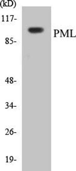 Immunology PML Colorimetric Cell-Based ELISA Kit