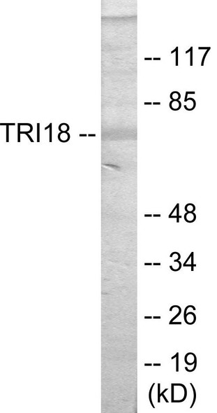 Signal Transduction TRI18 Colorimetric Cell-Based ELISA
