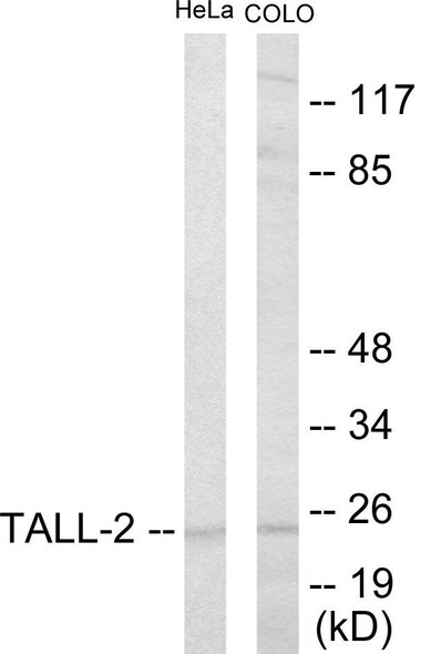 Immunology TALL-2 Colorimetric Cell-Based ELISA