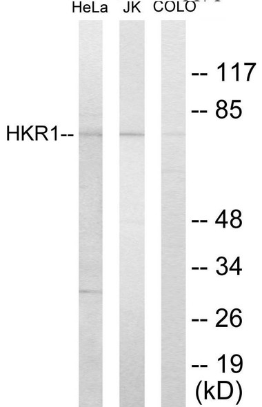 Epigenetics and Nuclear Signaling HKR1 Colorimetric Cell-Based ELISA