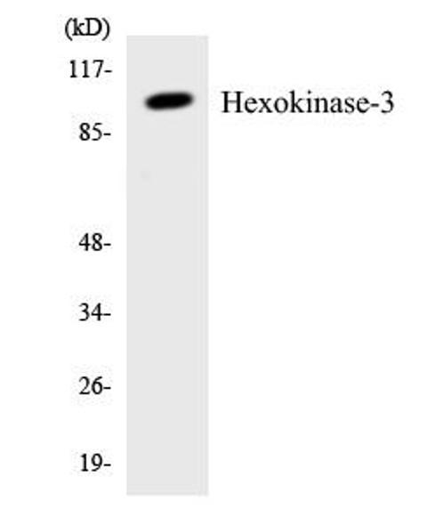 Metabolism Hexokinase-3 Colorimetric Cell-Based ELISA