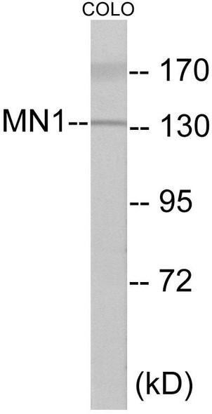 Epigenetics and Nuclear Signaling MN1 Colorimetric Cell-Based ELISA