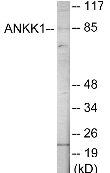 ANKK1 Colorimetric Cell-Based ELISA