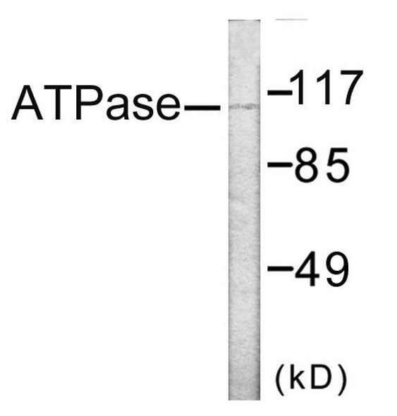 Signal Transduction ATPase Colorimetric Cell-Based ELISA