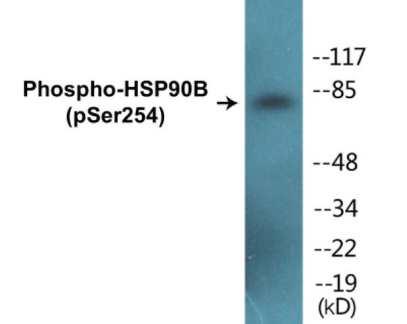 HSP90B Phospho-Ser254 Colorimetric Cell-Based ELISA Kit