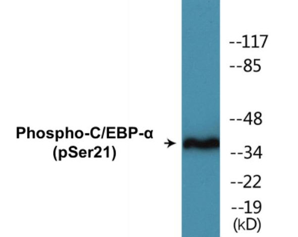 C/EBP-alpha Phospho-Ser21 Colorimetric Cell-Based ELISA Kit