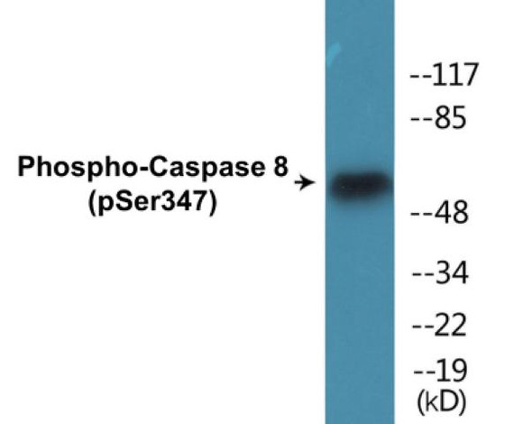 Caspase 8 Phospho-Ser347 Colorimetric Cell-Based ELISA Kit