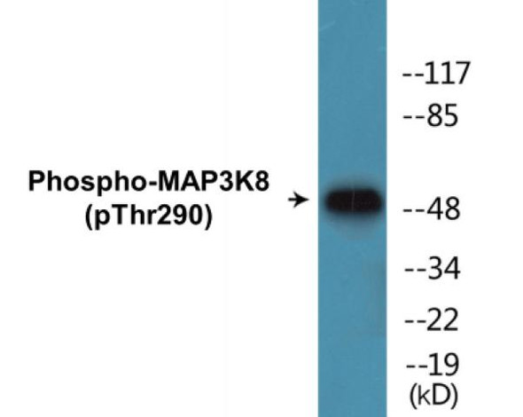 MAP3K8 Phospho-Thr290 Colorimetric Cell-Based ELISA Kit