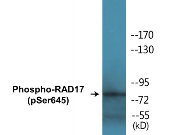 RAD17 Phospho-Ser645 Colorimetric Cell-Based ELISA Kit