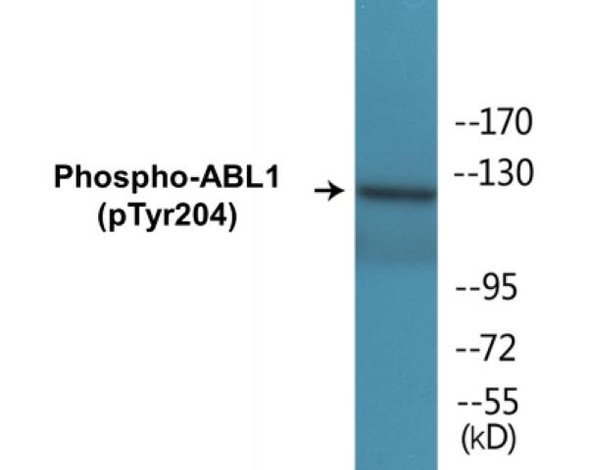 ABL1 Phospho-Tyr204 Colorimetric Cell-Based ELISA Kit