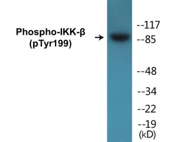 IKK-beta Phospho-Tyr199 Colorimetric Cell-Based ELISA Kit