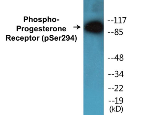 Progesterone Receptor Phospho-Ser294 Colorimetric Cell-Based ELISA Kit