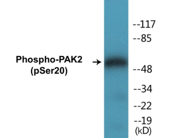 PAK2 Phospho-Ser20 Colorimetric Cell-Based ELISA Kit