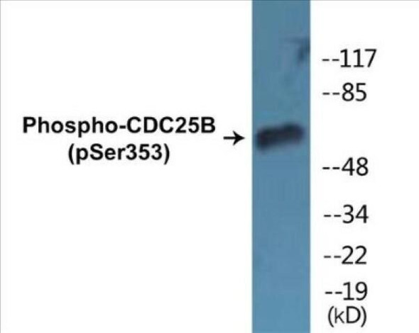 CDC25B Phospho-Ser353 Colorimetric Cell-Based ELISA Kit