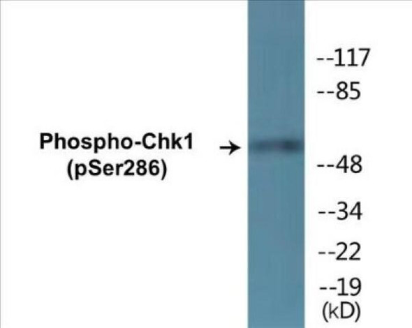 Chk1 Phospho-Ser286 Colorimetric Cell-Based ELISA Kit