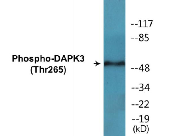 DAPK3 Phospho-Thr265 Colorimetric Cell-Based ELISA Kit