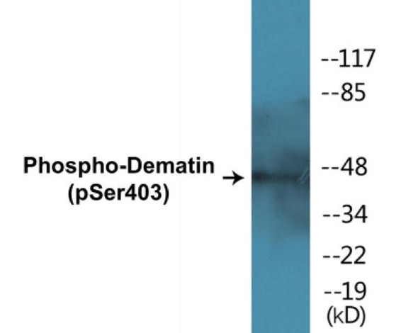 Dematin Phospho-Ser403 Colorimetric Cell-Based ELISA Kit