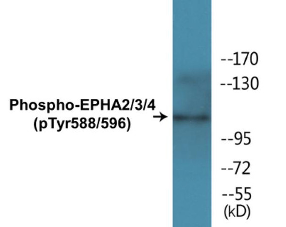 Phospho-EPHA2/3/4 Tyr588/596 In-Cell ELISA
