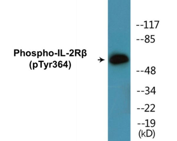 IL-2Rbeta Phospho-Tyr364 Colorimetric Cell-Based ELISA Kit