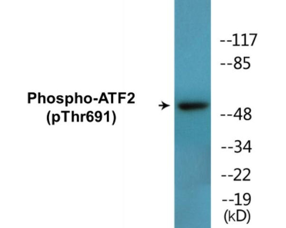 ATF2 Phospho-Thr691 Colorimetric Cell-Based ELISA Kit