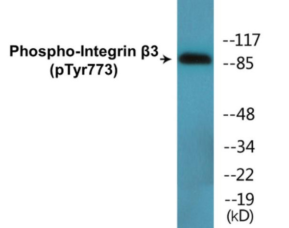 Integrin beta3 Phospho-Tyr773 Colorimetric Cell-Based ELISA Kit