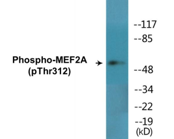 MEF2A Phospho-Thr312 Colorimetric Cell-Based ELISA Kit