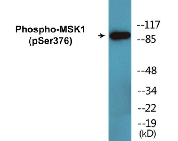 MSK1 Phospho-Ser376 Colorimetric Cell-Based ELISA Kit