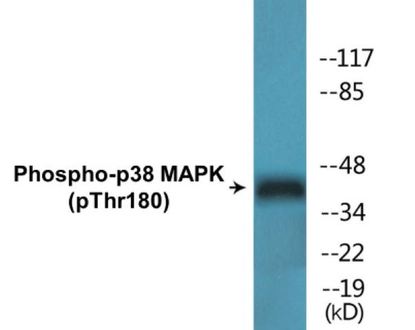 p38 MAPK Phospho-Thr180 Colorimetric Cell-Based ELISA Kit