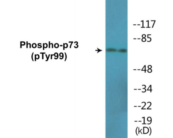 p73 Phospho-Tyr99 Colorimetric Cell-Based ELISA Kit