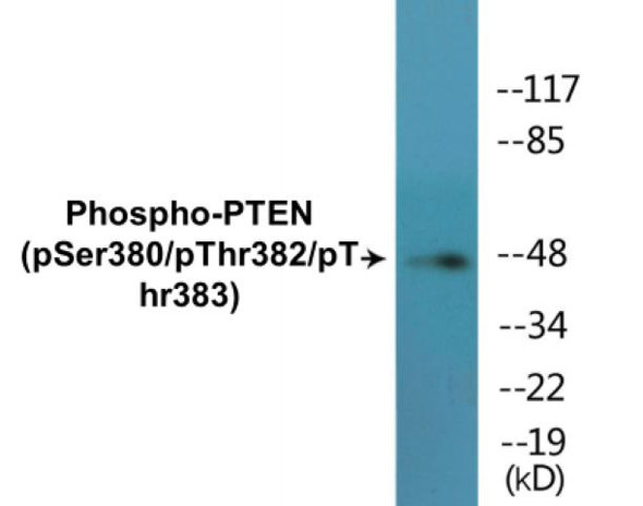 PTEN Phospho-Ser380/Thr382/Thr383 Colorimetric Cell-Based ELISA Kit