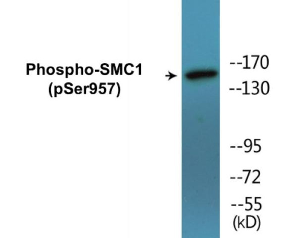 SMC1 Phospho-Ser957 Colorimetric Cell-Based ELISA Kit