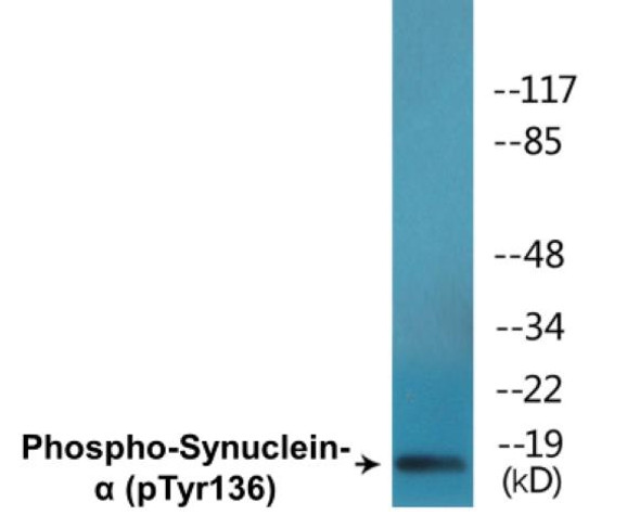 Synuclein-alpha Phospho-Tyr136 Colorimetric Cell-Based ELISA Kit