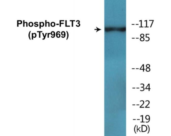 FLT3 Phospho-Tyr969 Colorimetric Cell-Based ELISA Kit