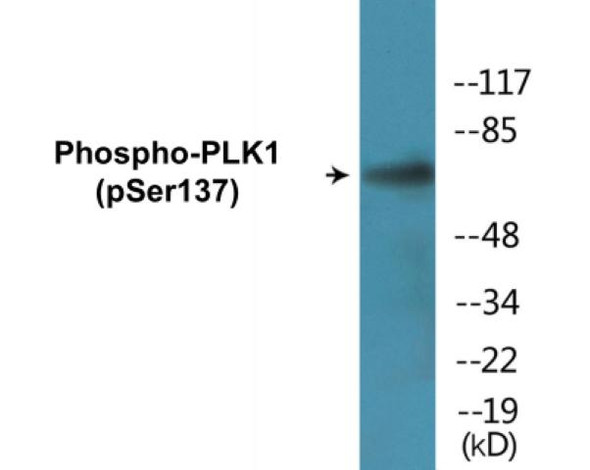 PLK1 Phospho-Ser137 Colorimetric Cell-Based ELISA Kit