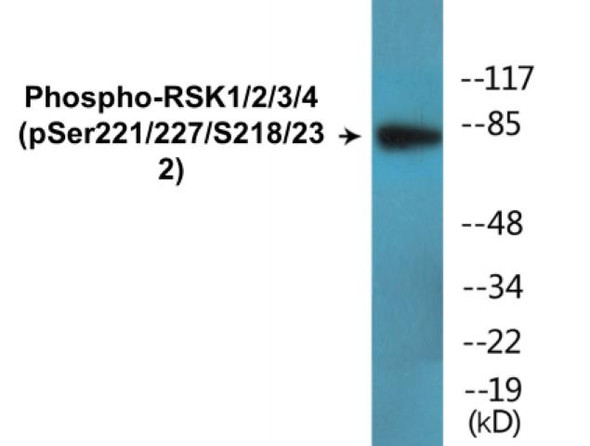 RSK1/2/3/4 Phospho-Ser221/227/S218/232 Colorimetric Cell-Based ELISA Kit