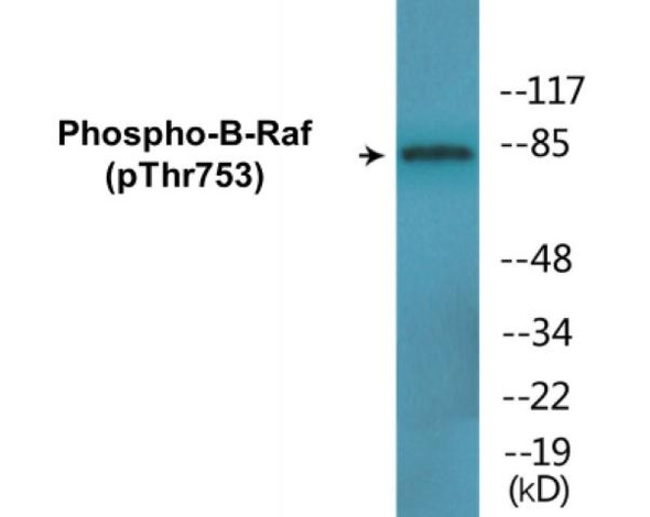 B-Raf Phospho-Thr753 Colorimetric Cell-Based ELISA Kit