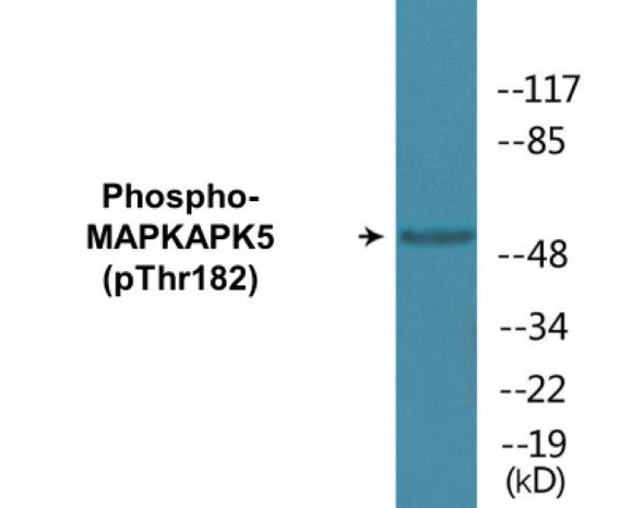 MAPKAPK5 Phospho-Thr182 Colorimetric Cell-Based ELISA Kit