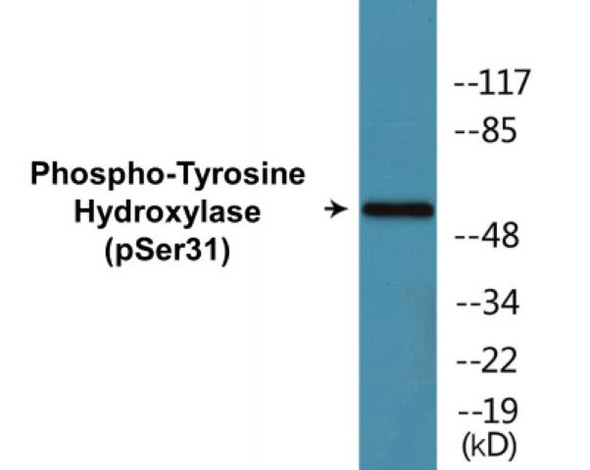 Tyrosine Hydroxylase Phospho-Ser31 Fluorometric Cell-Based ELISA Kit