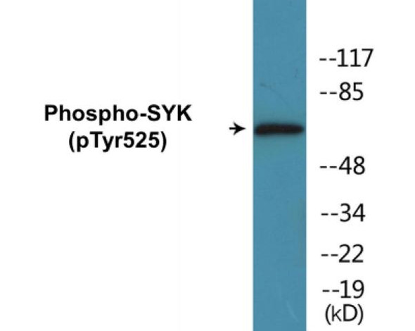 SYK Phospho-Tyr525 Fluorometric Cell-Based ELISA Kit